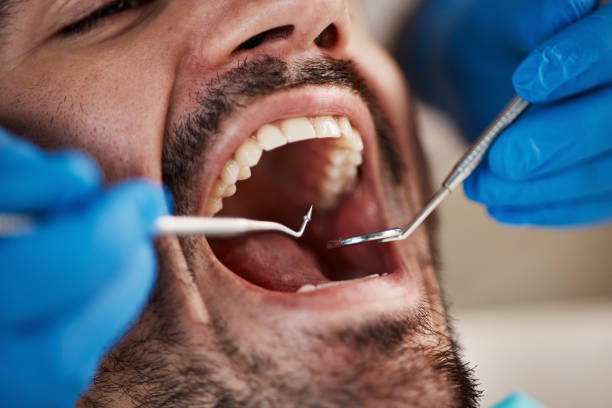 Best Emergency Dental Services for Seniors in Crystal Falls, MI