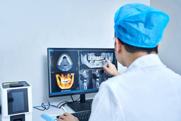 Best Emergency Dentist for Lost Fillings or Crowns in Crystal Falls, MI